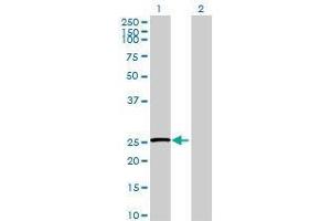 Lane 1: TMED5 transfected lysate ( 26 KDa) Lane 2: Non-transfected lysate. (TMED5 293T Cell Transient Overexpression Lysate(Denatured))