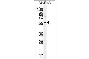 LOC129293 Antibody (C-term) (ABIN655687 and ABIN2845146) western blot analysis in SK-BR-3 cell line lysates (35 μg/lane). (TRABD2A antibody  (C-Term))