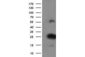 HEK293T cells were transfected with the pCMV6-ENTRY control (Left lane) or pCMV6-ENTRY ZFAND2B (Right lane) cDNA for 48 hrs and lysed. (ZFAND2B antibody)