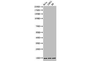 Western Blot analysis of HELA 22RV1 KB cells using Acetyl-Histone H3 (K27) Polyclonal Antibody (HIST1H3A/HIST2H3A/H3F3A (acLys27) antibody)