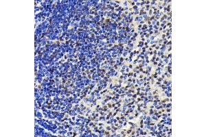 Immunohistochemistry of paraffin-embedded rat spleen using SP1 antibody (ABIN7270505) at dilution of 1:100 (40x lens). (SP1 antibody)