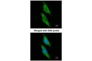 ICC/IF Image Immunofluorescence analysis of paraformaldehyde-fixed HeLa, using ARA9 , antibody at 1:200 dilution. (AIP antibody)