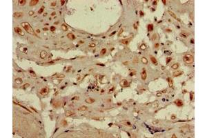 Immunohistochemistry of paraffin-embedded human placenta tissue using ABIN7175730 at dilution of 1:100 (WDR19 antibody  (AA 45-226))