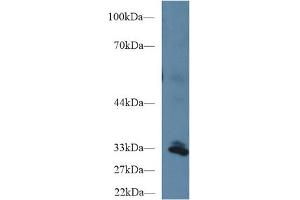 Western Blot; Sample: Human Liver lysate; Primary Ab: 1µg/ml Rabbit Anti-Human PPIE Antibody Second Ab: 0. (PPIE antibody  (AA 41-264))
