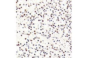 Immunohistochemistry of paraffin embedded rat embryonic rat using BRN3A (ABIN7075163) at dilution of 1:700 (400x lens) (POU4F1 antibody)
