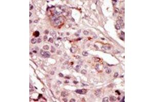 Image no. 2 for anti-Src-Related Kinase Lacking C-Terminal Regulatory Tyrosine and N-Terminal Myristylation Sites (SRMS) (N-Term) antibody (ABIN359993) (SRMS antibody  (N-Term))