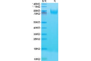 Mouse CD34 on Tris-Bis PAGE under reduced condition. (CD34 Protein (CD34) (AA 35-287) (His tag))