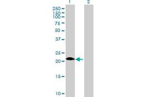 Western Blot analysis of ASB6 expression in transfected 293T cell line by ASB6 MaxPab polyclonal antibody. (ASB6 antibody  (AA 1-197))