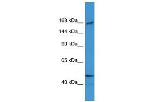 Western Blot showing BTBD12 antibody used at a concentration of 1-2 ug/ml to detect its target protein. (BTBD12 antibody  (N-Term))