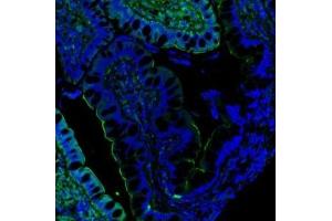 IF analysis of Villin using anti-Villin antibody (ABIN3042343). (Villin 1 antibody  (C-Term))