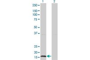 Western Blot analysis of IFNA2 expression in transfected 293T cell line by IFNA2 monoclonal antibody (M37), clone 2D6. (IFNA2 antibody  (AA 24-188))