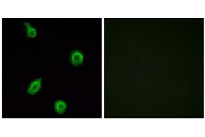 Immunofluorescence analysis of HUVEC cells, using HTR5B antibody. (HTR5B antibody  (C-Term))