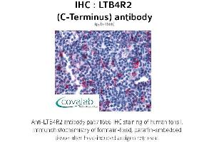 Image no. 1 for anti-Leukotriene B4 Receptor 2 (LTB4R2) (C-Term) antibody (ABIN1736595) (LTB4R2 antibody  (C-Term))