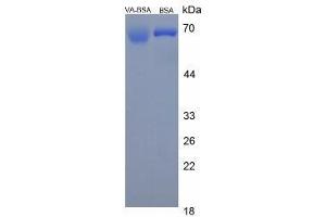 Image no. 1 for Vitamin A protein (BSA) (ABIN1880113)