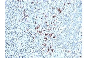 Formalin-fixed, paraffin-embedded human Tonsil stained with Kappa Light Chain Mouse Monoclonal Antibody (KLC264). (IGKC antibody)