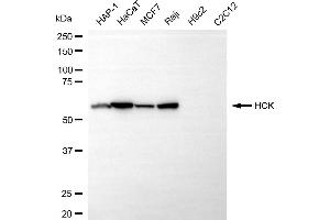 Western blotting analysis using HCK antibody (ABIN7798887).