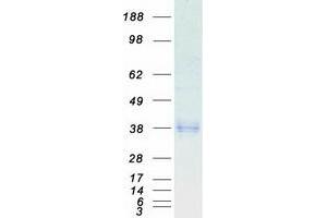 Validation with Western Blot