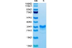 Biotinylated Mouse IL-17F on Tris-Bis PAGE under reduced condition. (IL17F Protein (AA 29-161) (His-Avi Tag,Biotin))