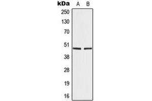 Western blot analysis of IRF4 expression in A549 (A), Ramos (B) whole cell lysates.