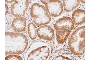 IHC-P Image Immunohistochemical analysis of paraffin-embedded human gastric tissue, using ENO1, antibody at 1:100 dilution. (ENO1 antibody)