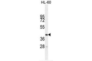 BTNL3 Antibody (C-term) western blot analysis in HL-60 cell line lysates (35µg/lane). (BTNL3 antibody  (C-Term))