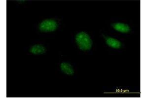 Immunofluorescence of purified MaxPab antibody to ARL3 on HeLa cell. (ARL3 antibody  (AA 1-182))