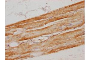 IHC image of ABIN7160584 diluted at 1:100 and staining in paraffin-embedded human skeletal muscle tissue performed on a Leica BondTM system. (MYH6 antibody  (AA 894-1132))