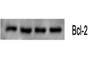 Western Blot (WB) analysis: Please contact us for more details. (Bcl-2 antibody)