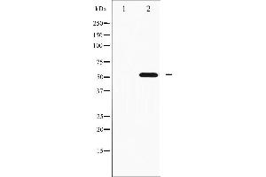 Western blot analysis of p70 S6 Kinase beta phosphorylation expression in EGF treated K562 whole cell lysates,The lane on the left is treated with the antigen-specific peptide. (RPS6KB2 antibody  (pSer423))
