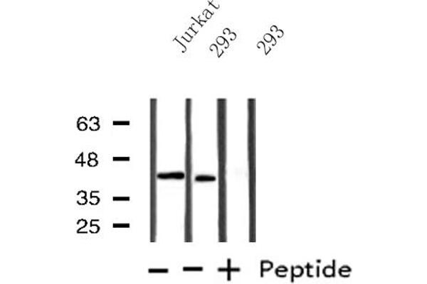 B4GALT1 antibody  (C-Term)