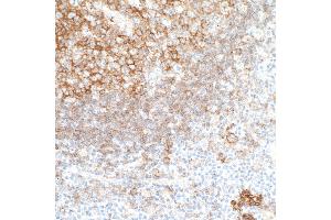Immunohistochemistry (IHC) image for anti-CD40 (CD40) (AA 227-277) antibody (ABIN7454023) (Recombinant CD40 antibody  (AA 227-277))