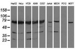 Image no. 2 for anti-Pseudouridylate Synthase 7 Homolog (PUS7) antibody (ABIN1500515) (PUS7 antibody)