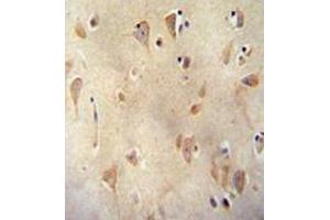 Immunohistochemistry analysis in formalin fixed and paraffin embedded human brain tissue reacted with  LRRC40 Antibody (C-term) followed which was peroxidase conjugated to the secondary antibody and followed by  DAB staining. (LRRC40 antibody  (C-Term))