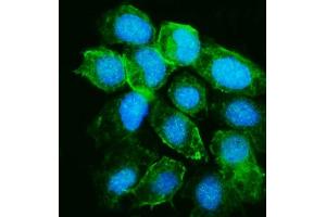 IF analysis of YARS1 using anti-YARS1 antibody (ABIN7601158). (YARS1 (AA 294-523) antibody)
