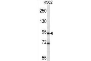 Western Blotting (WB) image for anti-MAP/microtubule Affinity-Regulating Kinase 1 (MARK1) antibody (ABIN2997857) (MARK1 antibody)