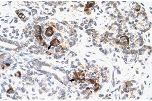 Human Pancreas (MEK2 antibody  (C-Term))