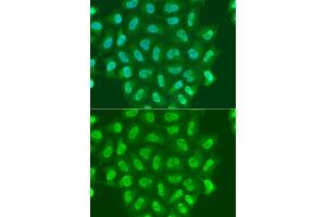 Immunofluorescence analysis of A549 cell using POLR2A antibody. (POLR2A/RPB1 antibody)
