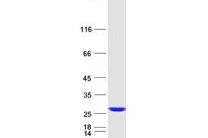 Validation with Western Blot