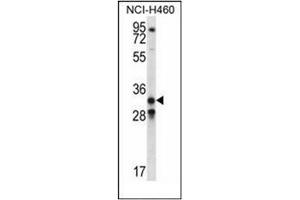 Western blot analysis of GDF15 Antibody (N-term) in NCI-H460 cell line lysates (35ug/lane). (GDF15 antibody  (N-Term))