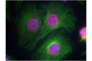 Immunofluorescence staining of methanol-fixed Hela cells using p53 (Phospho-Ser15) Antibody. (p53 antibody  (pSer15))