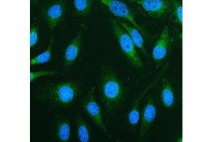 IF analysis of TOMM20 using anti-TOMM20 antibody (ABIN7600883).