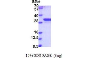 SDS-PAGE (SDS) image for Nucleotide Binding Protein 2 (NUBP2) (AA 1-271) protein (His tag) (ABIN5853987)
