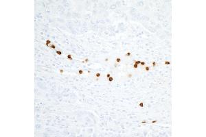 Immunohistochemistry (IHC) image for anti-Carcinoembryonic Antigen-Related Cell Adhesion Molecule 8 (CEACAM8) (AA 23-320) antibody (ABIN7453895)