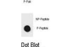 Dot blot analysis of IKKB Antibody (Phospho ) Phospho-specific Pab (ABIN1881449 and ABIN2850465) on nitrocellulose membrane.