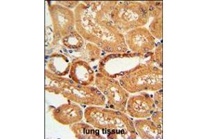COQ9 Antibody immunohistochemistry analysis in formalin fixed and paraffin embedded human lung tissue followed by peroxidase conjugation of the secondary antibody and DAB staining. (COQ9 antibody  (AA 156-184))