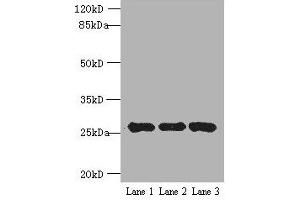 Western blot All lanes: EXOSC5 antibody at 5 μg/mL Lane 1: K562 whole cell lysate Lane 2: 293T whole cell lysate Lane 3: Hela whole cell lysate Secondary Goat polyclonal to rabbit IgG at 1/10000 dilution Predicted band size: 25 kDa Observed band size: 25 kDa