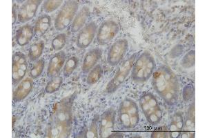 Immunoperoxidase of monoclonal antibody to LRRFIP1 on formalin-fixed paraffin-embedded human small Intestine. (LRRFIP1 antibody  (AA 675-784))