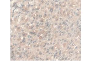 IHC-P analysis of Rat Stomach Tissue, with DAB staining. (Androgen Receptor antibody  (AA 491-679))