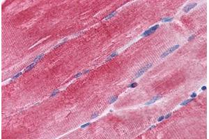 Human Skeletal Muscle: Formalin-Fixed, Paraffin-Embedded (FFPE) (BAG3 antibody  (AA 563-575))