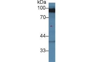 Western blot analysis of Rat Cerebrum lysate, using Human DLG3 Antibody (2 µg/ml) and HRP-conjugated Goat Anti-Rabbit antibody (